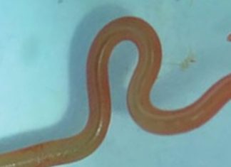 Investigadores encuentran por primera vez un gusano vivo en el cerebro de una mujer