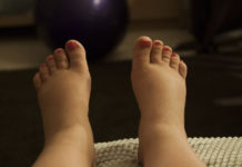 3 problemas de salud que revela la hinchazón en los tobillos
