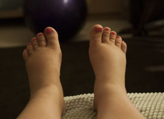 3 problemas de salud que revela la hinchazón en los tobillos