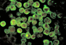 Revelan detalles sobre el caso de la ‘ameba comecerebros’ que causó muerte de una niña en Colombia