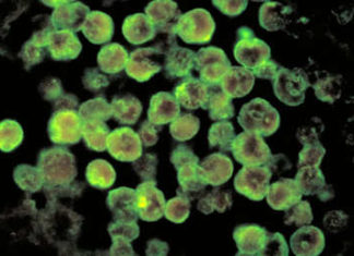 Revelan detalles sobre el caso de la ‘ameba comecerebros’ que causó muerte de una niña en Colombia