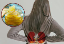 ¿Cómo el jugo de limón afecta los riñones? En especial cuando lo tomas en ayuno