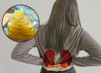 ¿Cómo el jugo de limón afecta los riñones? En especial cuando lo tomas en ayuno