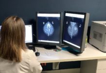 Detección temprana del cáncer de mama es fundamental
