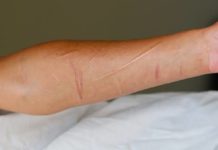 Treinta por ciento de los menores se autolesionan