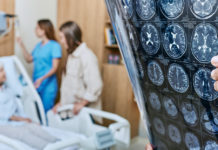 Descubren que un tratamiento médico obsoleto pudo causar transmisión de alzhéimer