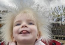 “El pelo de mi hija es hermoso”: qué es el síndrome del cabello impeinable causado por una mutación genética