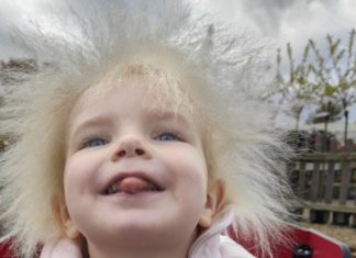 “El pelo de mi hija es hermoso”: qué es el síndrome del cabello impeinable causado por una mutación genética