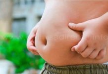Más de seis mil obesos diagnosticados en Tamaulipas