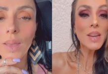 Ivonne Montero se asusta con reacción alérgica