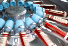 Varias personas contrajeron VIH a través del ‘vampiro facial’ en EE.UU.