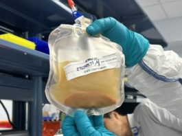 Cultivan un ‘minihígado’ en un paciente