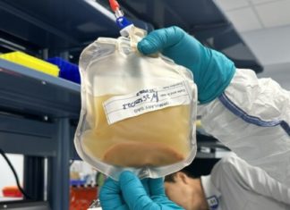 Cultivan un ‘minihígado’ en un paciente