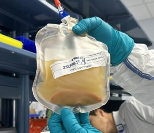 Cultivan un ‘minihígado’ en un paciente