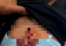 Buscan a joven que presuntamente lesionó con arma blanca y golpeo a una mujer