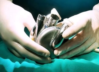 Por primera vez en la historia un corazón de titanio se puso en un cuerpo humano: más que un órgano, parece un motor de auto deportivo