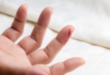 Tamaulipas ocupa segundo lugar nacional en casos de tétanos