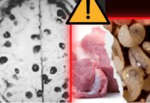 Contagios peligrosos triquinelosis y cisticercosis enferman a tamaulipecos