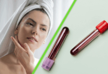 La ciencia acaba de descubrir cómo la sangre joven reactiva células para rejuvenecer la piel humana