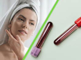 La ciencia acaba de descubrir cómo la sangre joven reactiva células para rejuvenecer la piel humana