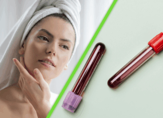 La ciencia acaba de descubrir cómo la sangre joven reactiva células para rejuvenecer la piel humana